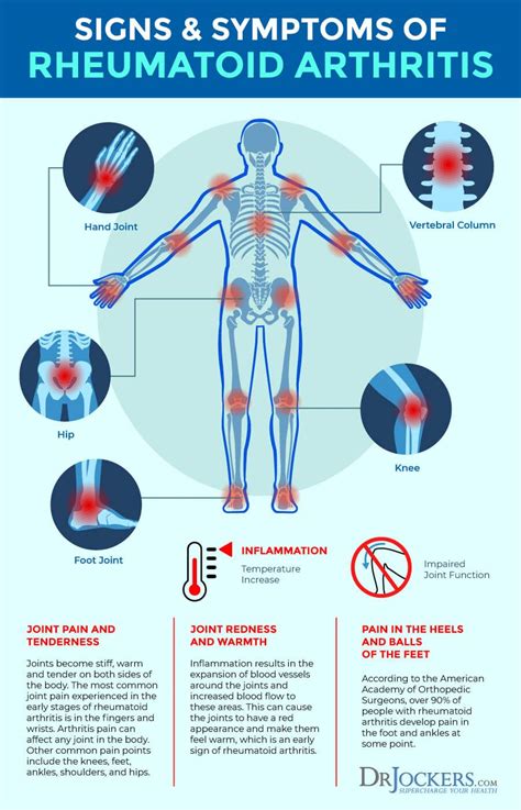 風濕病|類風濕性關節炎 健康主題 (Rheumatoid Arthritis) 